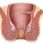 Obat Ambeien,obat Ambeien ampuh,ambefree