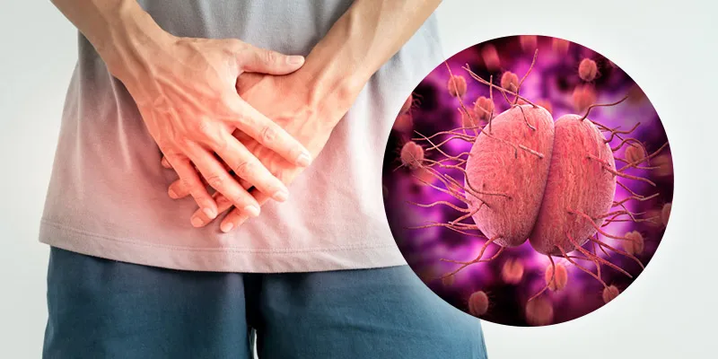 obat kencing nanah ampuh,obat gonore,obat kencing nanah vigrofit